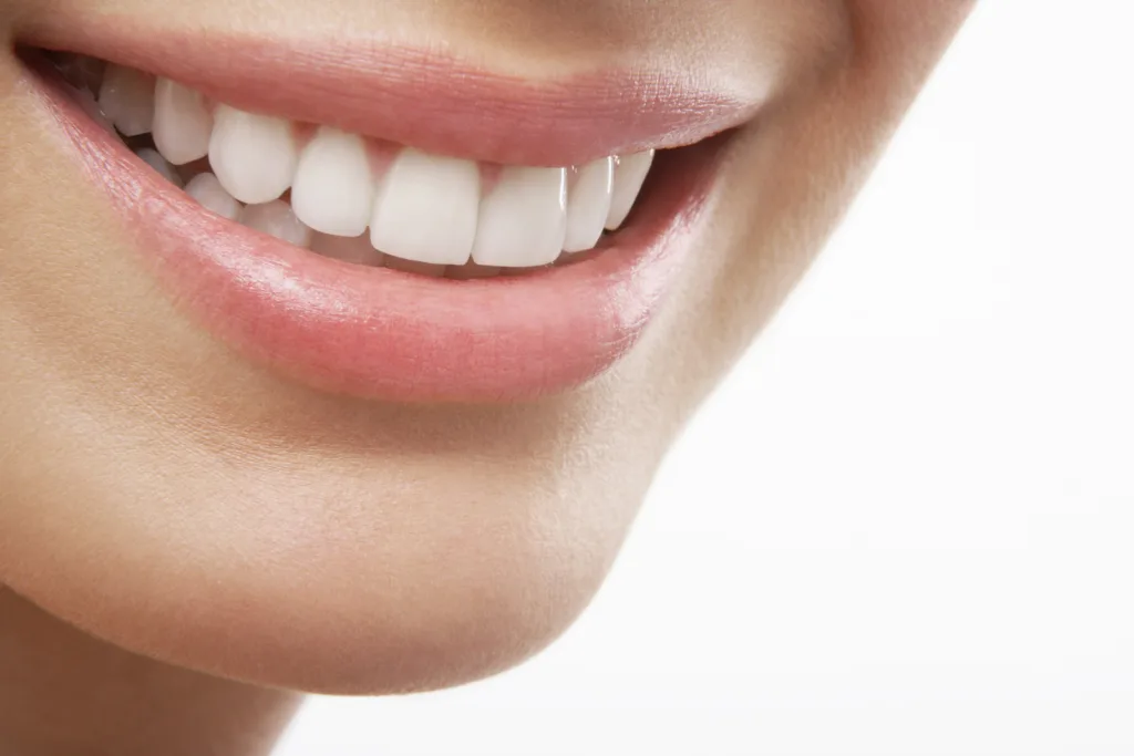 Wybielanie zębów u dentysty- jaki jest koszt?