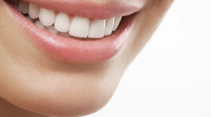 Wybielanie zębów u dentysty- jaki jest koszt?