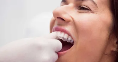 ortodontka zakłada Clear Aligner pacjentce